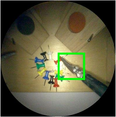 Robotic Endoscope Control Via Autonomous Instrument Tracking